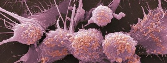 How Cancer Eats Itself To Survive Our Therapies How Cancer Eats Itself To Survive Our Therapies
