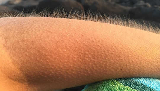 Why Do Powerful Songs Give You Goose Bumps? Why Do Powerful Songs Give You Goose Bumps?