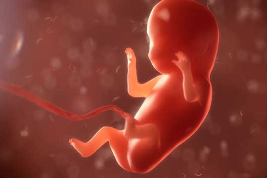 What Causes Most Birth Defects What Causes Most Birth Defects