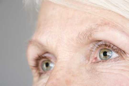 Age-Related Macular Degeneration Explained Age-Related Macular Degeneration Explained