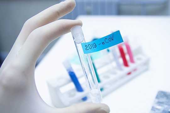 Testing Shortages Force Extreme Shift In Strategy By Local Health Officials Testing Shortages Force Extreme Shift In Strategy By Local Health Officials