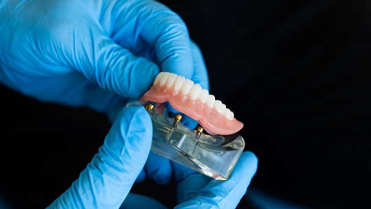 Tooth loss boosts dementia risk, but dentures may help dentures